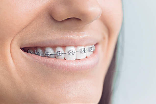 Trusted Burlington, WA Holistic Dental Care Services Experts