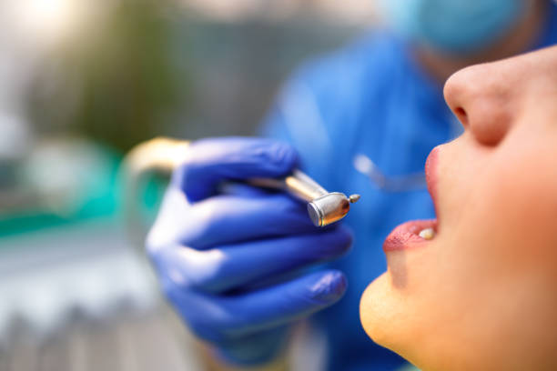 Best Veneers and Lumineers  in Burlington, WA